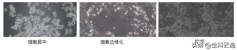 干货分享 | 如何铺出漂亮的细胞板？铺板成功的关键在于？